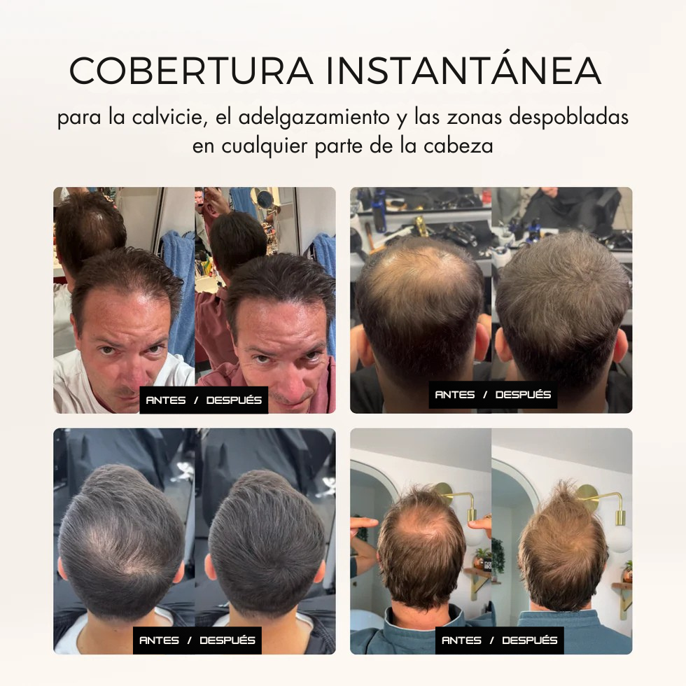 Camuflaje capilar